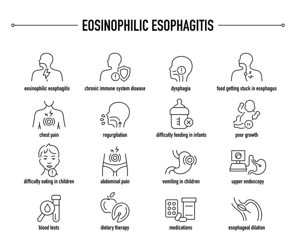 Eosinophilic Esophagitis Services in Atlanta, GA