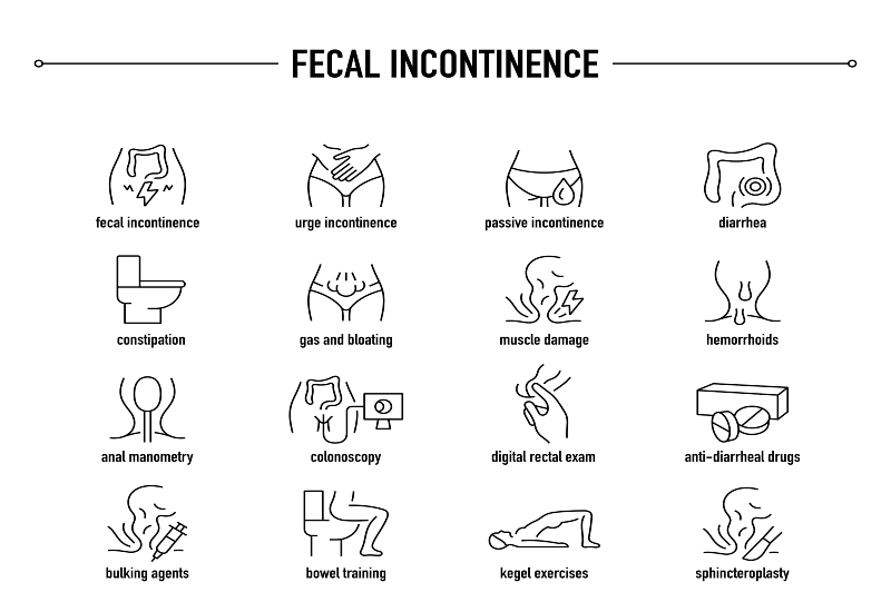 Fecal Incontinence Treatment in Atlanta, Georgia