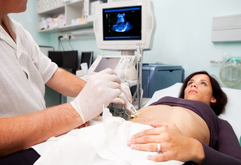 Doctor Performing a Liver Biopsy Procedure at GI Specialists of Georgia in Atlanta