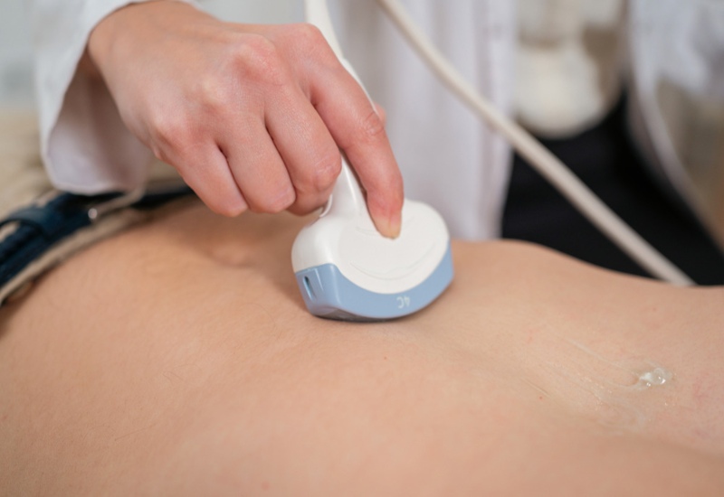 Ultrasound Machine Used by GI Specialists of Georgia to Diagnose Diseases in Atlanta, GA